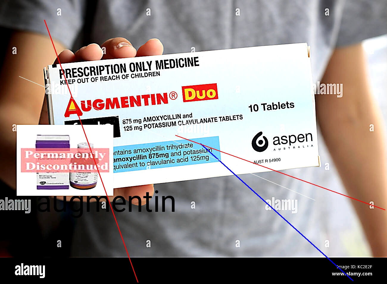 Augmentin générique amoxicilline